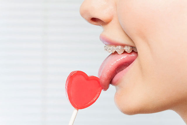 開咬（オープンバイト）の原因となる舌癖（舌のクセ）のイメージ